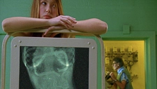 36.6 - Xray Teaser - 10